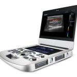 Ecógrafo EDAN AX3 VET