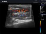 EDAN AX3 VET - Image 4