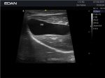 EDAN AX3 VET - Image 5
