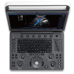 Ecógrafo Sonoscape E2V