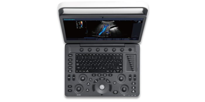 Sonoscape E2V - Image 1