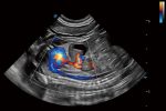 Sonoscape ProPet 70 - Image 6