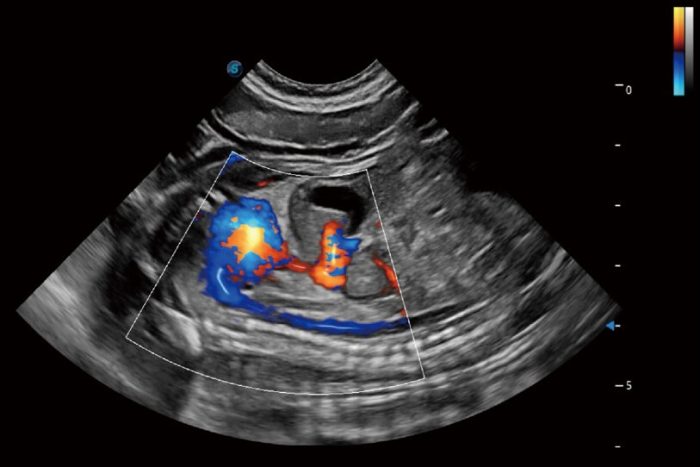 Sonoscape ProPet 70 - Image 6