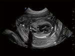 Sonoscape Propet 80 - Image 6