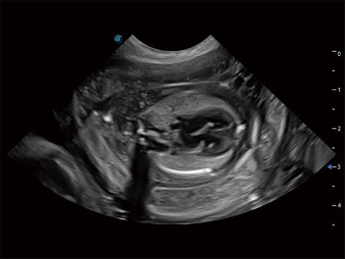 Sonoscape Propet 80 - Image 6