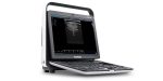 Sonoscape S8 ExpV