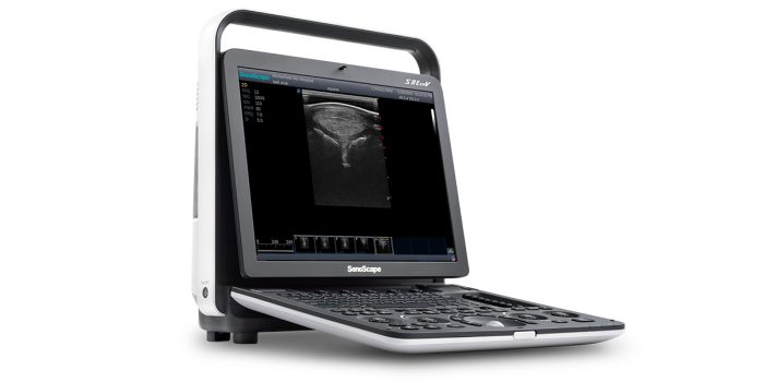 Sonoscape S8 ExpV - Image 1