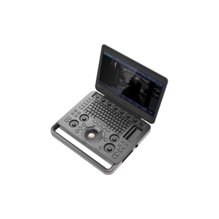 Sonoscape X3V - Image 1