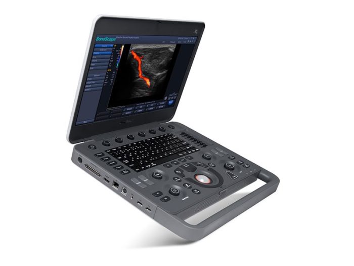 Sonoscape X5V - Image 1